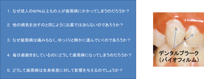 歯周病に対する疑問