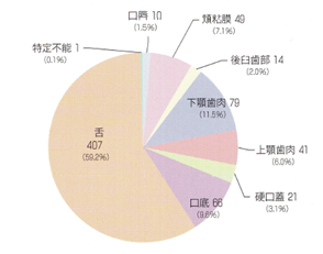 口腔がんの好発部位